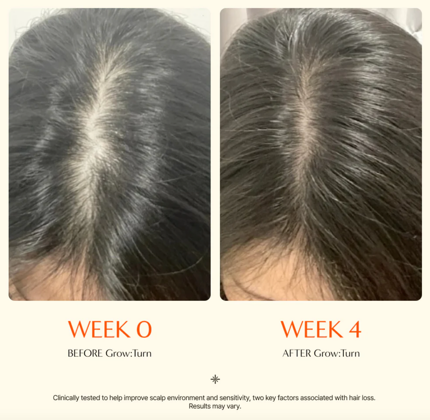 Growturn Hair Serum with Brush 100ml